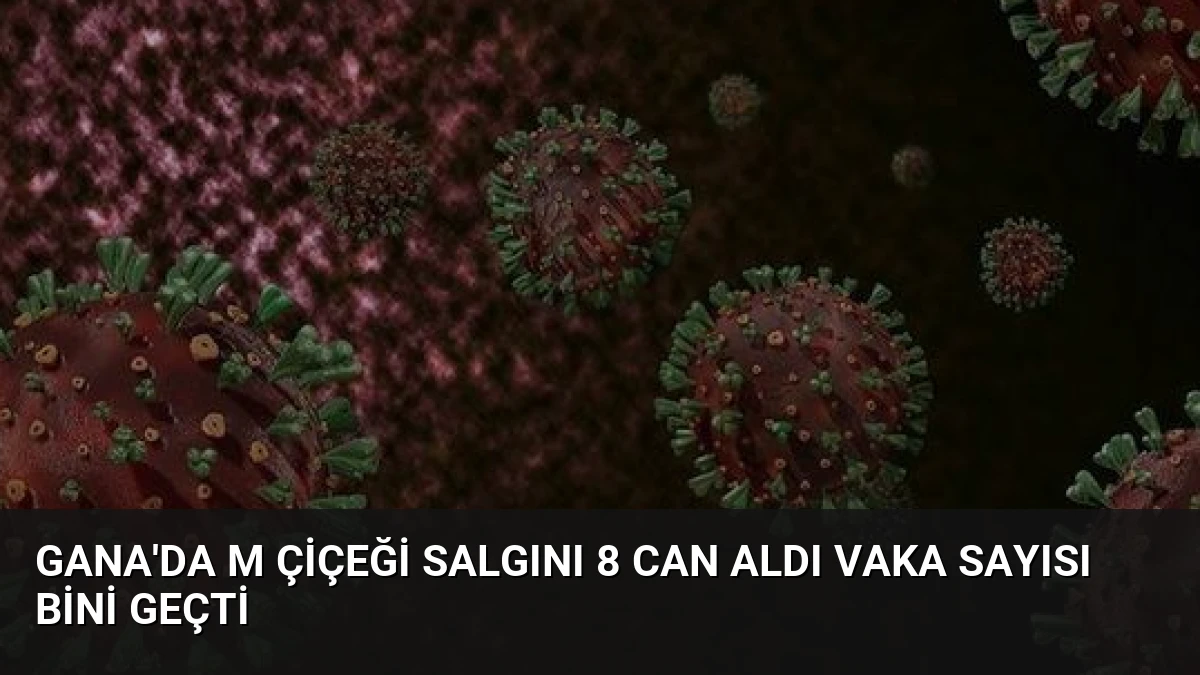 Gana’da M çiçeği salgını 8 can aldı vaka sayısı bini geçti