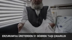 Erzurum'da Üreterden 51 Böbrek Taşı Çıkarıldı