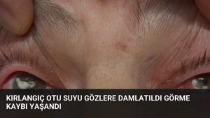 Kırlangıç Otu Suyu Gözlere Damlatıldı Görme Kaybı Yaşandı