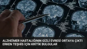 Alzheimer Hastalığının Gizli Evresi Ortaya Çıktı Erken Teşhis İçin Kritik Bulgular