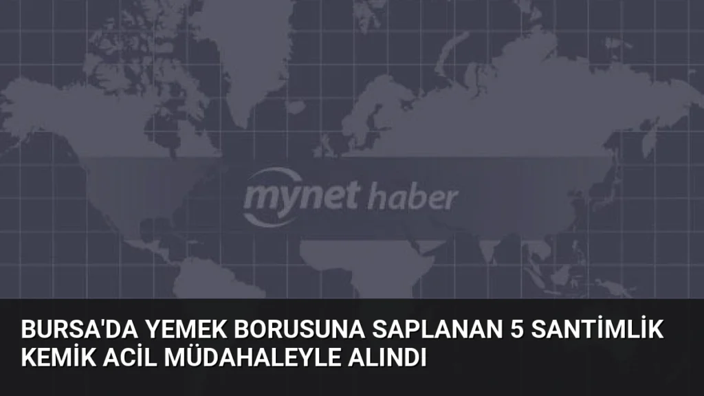 Bursa'da Yemek Borusuna Saplanan 5 Santimlik Kemik Acil Müdahaleyle Alındı