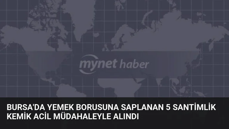 Bursa’da Yemek Borusuna Saplanan 5 Santimlik Kemik Acil Müdahaleyle Alındı