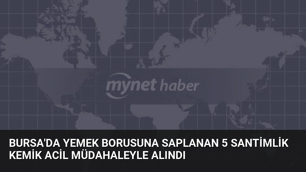 Bursa’da Yemek Borusuna Saplanan 5 Santimlik Kemik Acil Müdahaleyle Alındı
