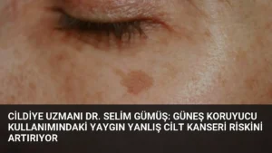 Cildiye Uzmanı Dr. Selim Gümüş: Güneş Koruyucu Kullanımındaki Yaygın Yanlış Cilt Kanseri Riskini Artırıyor
