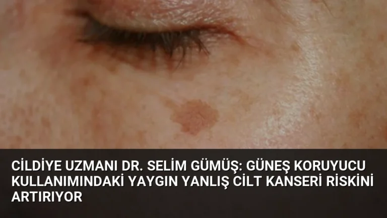 Cildiye Uzmanı Dr. Selim Gümüş: Güneş Koruyucu Kullanımındaki Yaygın Yanlış Cilt Kanseri Riskini Artırıyor