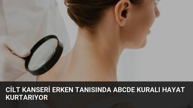 Cilt Kanseri Erken Tanısında ABCDE Kuralı Hayat Kurtarıyor