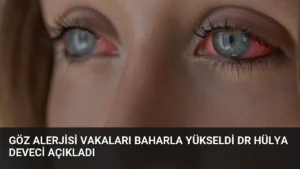 Göz Alerjisi Vakaları Baharla Yükseldi Dr Hülya Deveci Açıkladı
