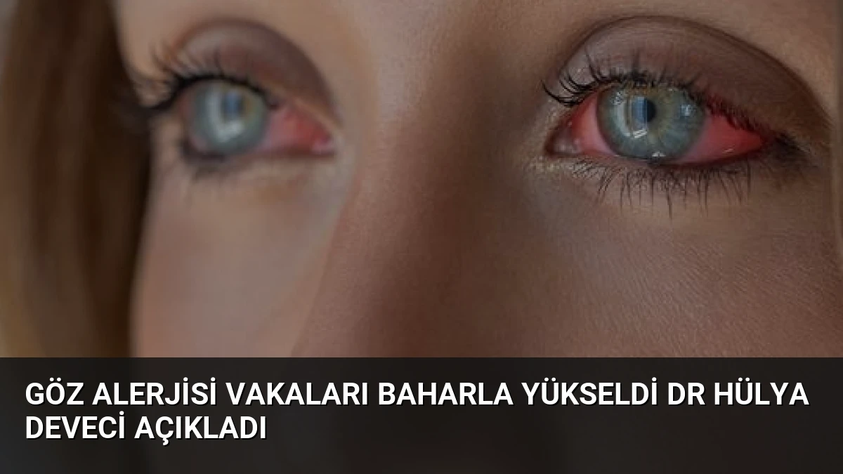 Göz Alerjisi Vakaları Baharla Yükseldi Dr Hülya Deveci Açıkladı