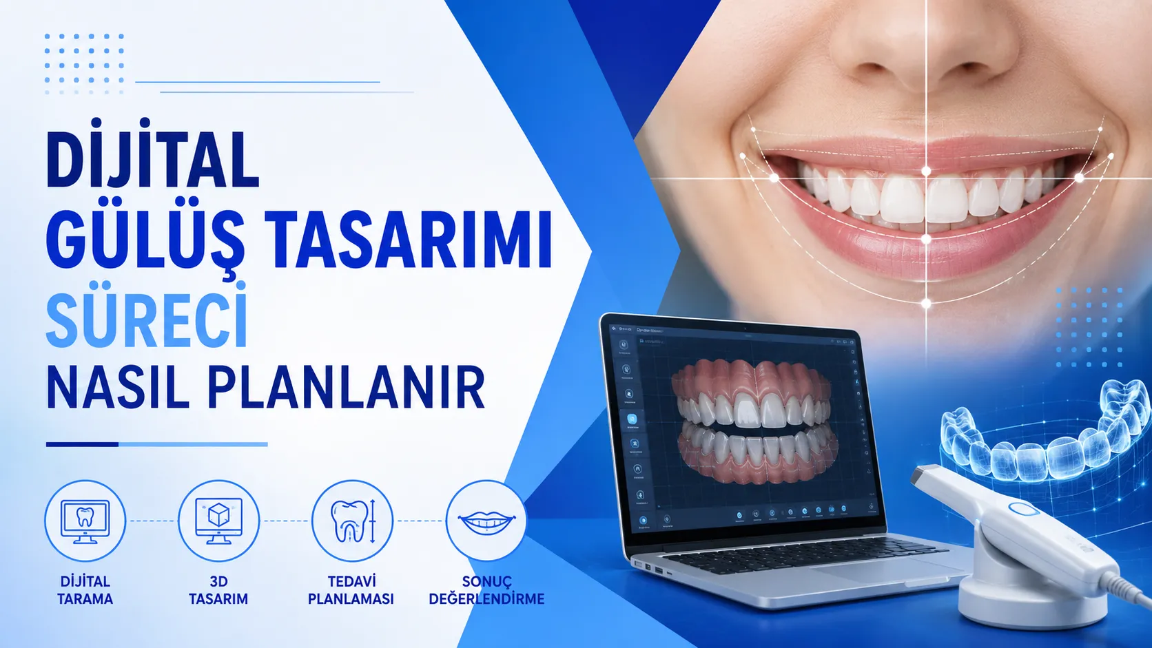 Dijital Gülüş Tasarımı Süreci Nasıl Planlanır